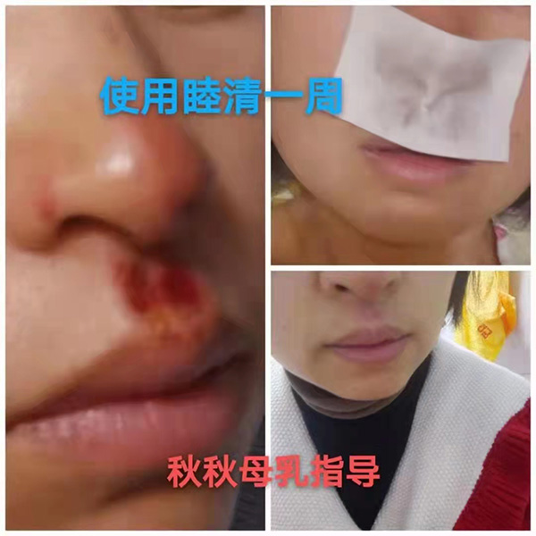 �����澏���N���Æ������M(f��i)�߿ڱ���������(sh��)���a(ch��n)ƷȦ�۟o��(sh��)